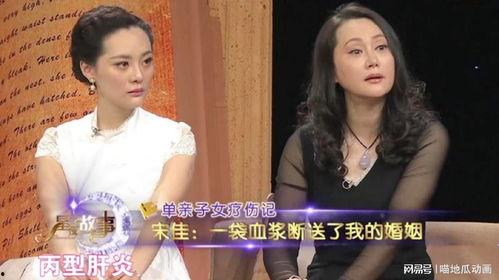 娱乐爆料宋佳是哪一期的,娱乐爆料揭秘哪一期精彩瞬间